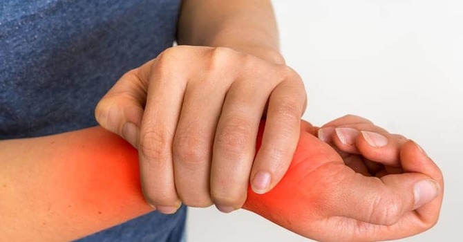 Chiropractic Care for Carpal Tunnel Syndrome image